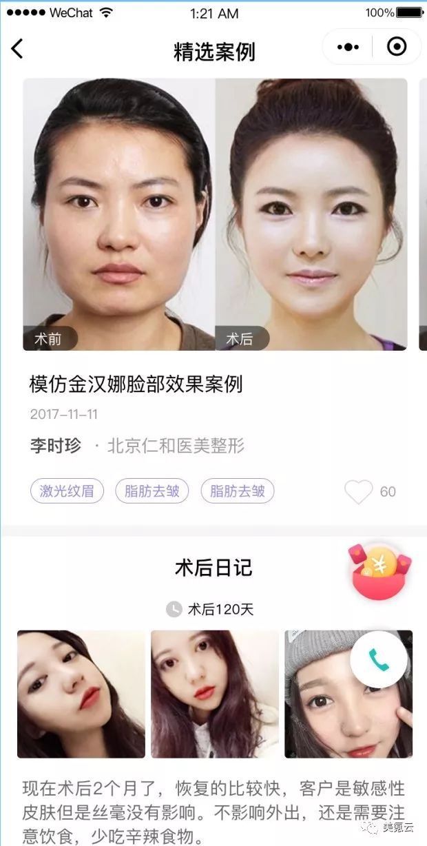 医美案例营销专家——美氪云撕去医美案例映现太LOW之痛赢博体育(图3)